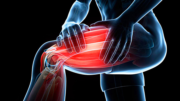 Unraveling the Mysteries of Muscle Spasms and Cramps