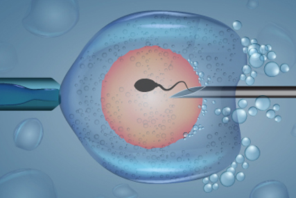 What is IVF Treatment?