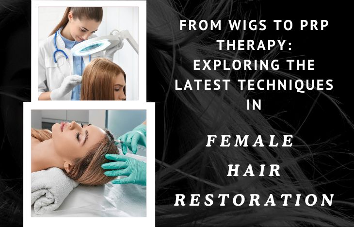 From Wigs to PRP Therapy: Exploring the Latest Techniques in Female Hair Restoration